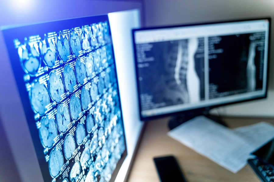 Dois monitores com resultados de procedimentos de diagnóstico por imagem