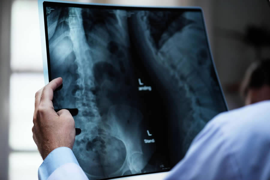 Um médico segurando um exame de raio-x.