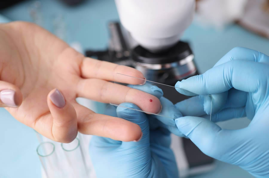 Teste de HIV sendo realizado no laboratório